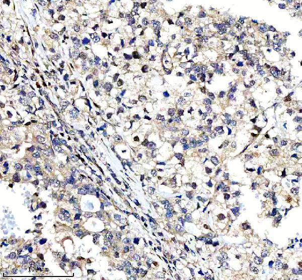 a11765 2 ccpg1 primary antibodies ihc testing 5