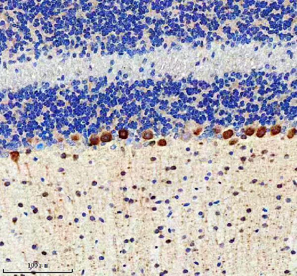 a11765 2 ccpg1 primary antibodies ihc testing 6