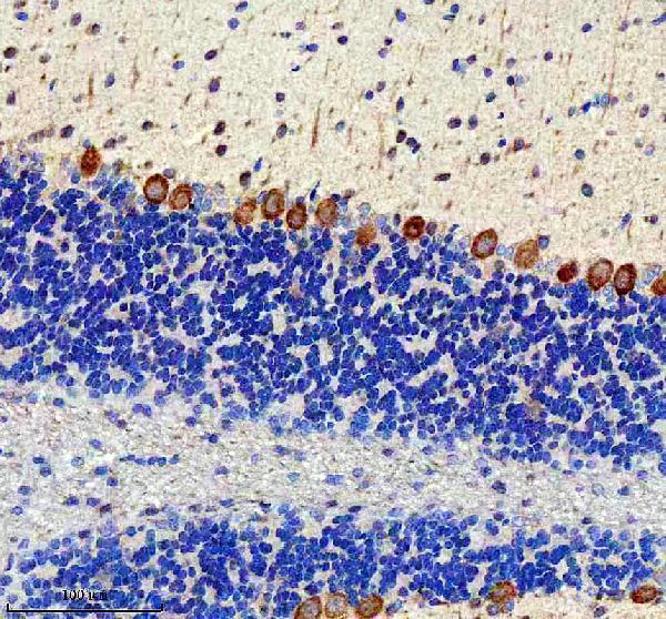 a11765 2 ccpg1 primary antibodies ihc testing 7