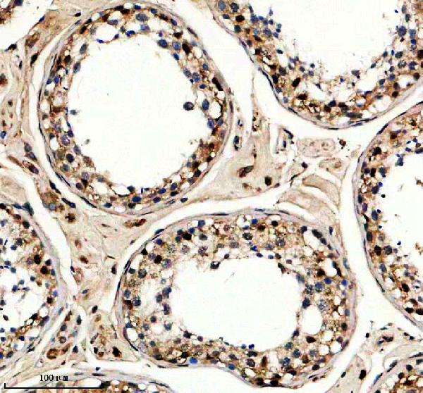 a11767 1 pole4 primary antibodies ihc testing 1