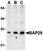 Western blot analysis of Bap29 in human heart tissue lysate with Bap29 antibody at (A) 0