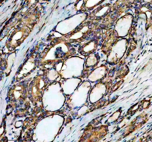 IHC analysis of DNAAF2 using anti-DNAAF2 antibody (A11772-1)