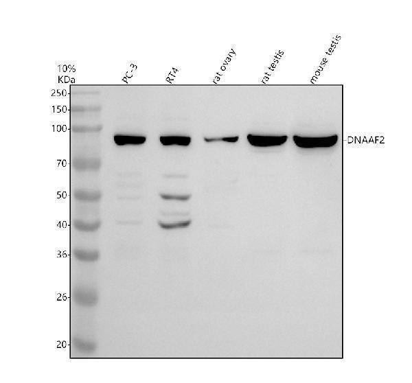 Western blot analysis of DNAAF2 using anti-DNAAF2 antibody (A11772-1)