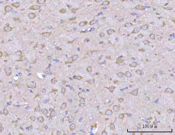 a11773 ppfia2 primary antibodies ihc testing 2