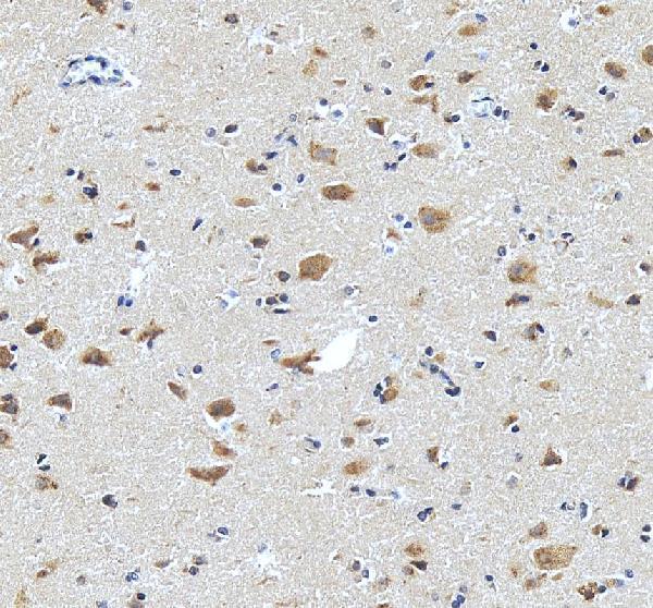 a11773 ppfia2 primary antibodies ihc testing 3