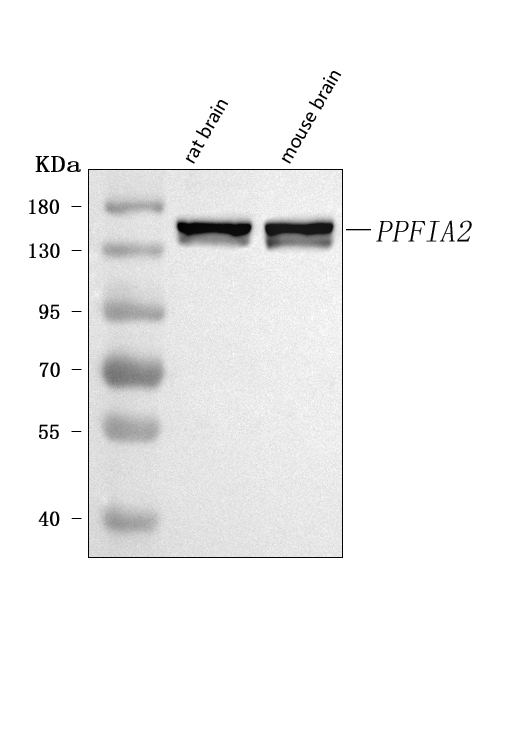 Figure 1. Western blot analysis of PPFIA2 using anti-PPFIA2 antibody (A11773). Electrophoresis was performed on a 5-20% SDS-PAGE gel at 70V (Stacking gel) / 90V (Resolving gel) for 2-3 hours. The sample well of each lane was loaded with 30 ug of sample under reducing conditions. Lane 1: rat brain tissue lysates, Lane 2: mouse brain tissue lysates. After electrophoresis, proteins were transferred to a nitrocellulose membrane at 150 mA for 50-90 minutes. Blocked the membrane with 5% non-fat milk/TBS for 1.5 hour at RT. The membrane was incubated with rabbit anti-PPFIA2 antigen affinity purified polyclonal antibody (Catalog # A11773) at 0.5 microg/mL overnight at 4°C, then washed with TBS-0.1%Tween 3 times with 5 minutes each and probed with a goat anti-rabbit IgG-HRP secondary antibody at a dilution of 1:5000 for 1.5 hour at RT. The signal is developed using an Enhanced Chemiluminescent detection (ECL) kit (Catalog # EK1002) with Tanon 5200 system. A specific band was detected for PPFIA2 at approximately 143 kDa. The expected band size for PPFIA2 is at 143 kDa.