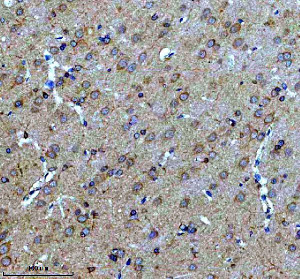 a11787 2 gpr139 primary antibodies ihc testing 1