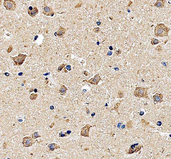 a11787 2 gpr139 primary antibodies ihc testing 2