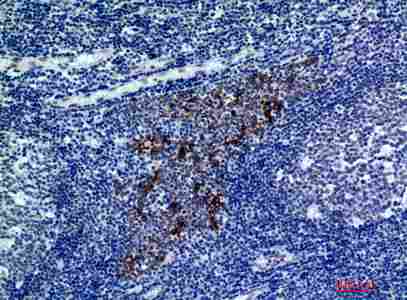 a11789 cmtm8 primary antibodyes ihc testing 3