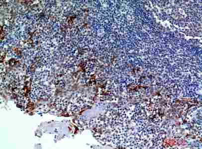 a11789 cmtm8 primary antibodyes ihc testing 4