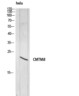 a11789 cmtm8 primary antibodyes wb testing 1