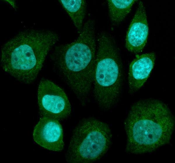 IF analysis of SLC25A21 using anti-SLC25A21 antibody (A11791-1)