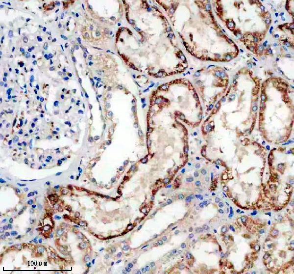 IHC analysis of SLC25A21 using anti-SLC25A21 antibody (A11791-1)
