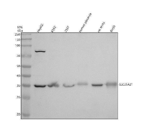 Western blot analysis of SLC25A21 using anti-SLC25A21 antibody (A11791-1)