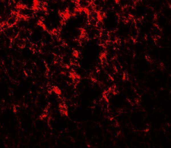 a11801 enho primary antibodies if testing 3