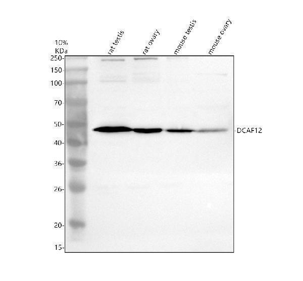 Western blot analysis of DCAF12 using anti-DCAF12 antibody (A11802-1)