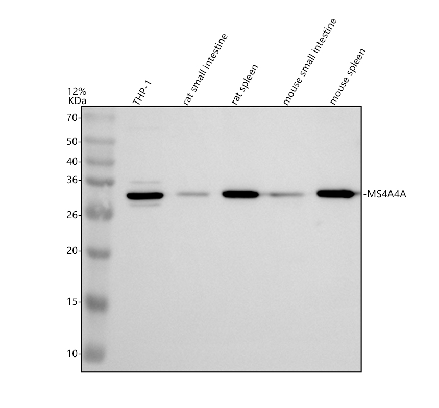 a11806 1 ms4a4a primary antibodies wb testing 1