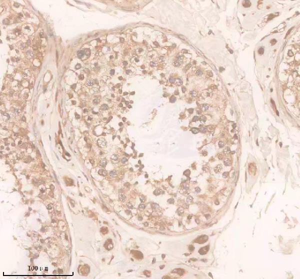 IHC analysis of DAND5 using anti-DAND5 antibody (A11812-2)