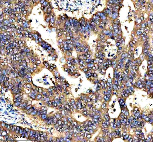  IHC analysis of RNF220 using anti-RNF220 antibody (A11818-1)