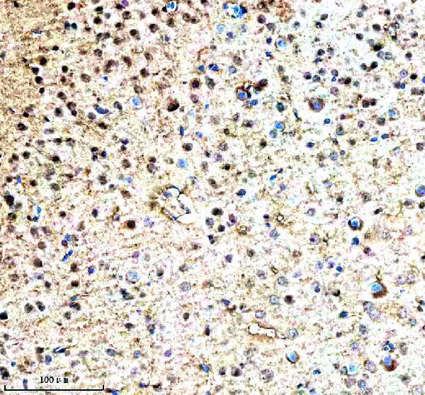  IHC analysis of RNF220 using anti-RNF220 antibody (A11818-1)