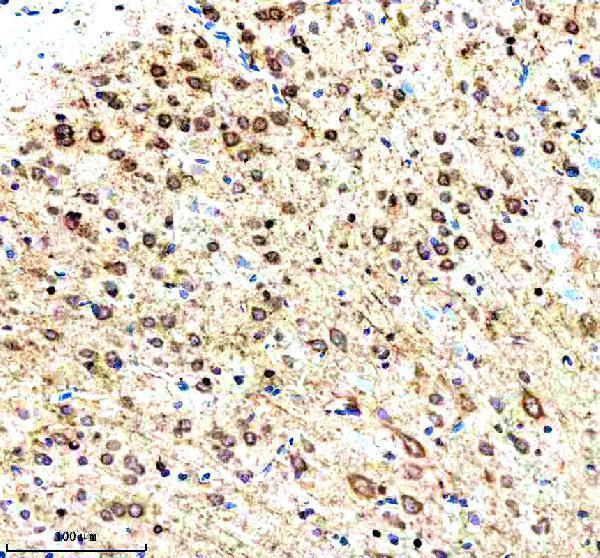 a11818 1 rnf220 primary antibodies ihc testing 4