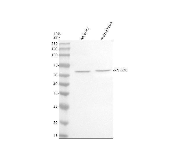  Western blot analysis of RNF220 using anti-RNF220 antibody (A11818-1)