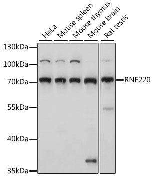 Western blot analysis of extracts of various cell lines, using RNF220 antibody