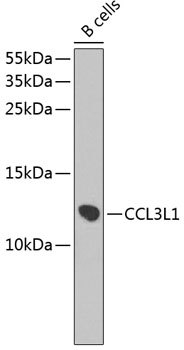 Western blot analysis of extracts of B-cell cells, using CCL3L1 antibody  at 1:1000 dilution