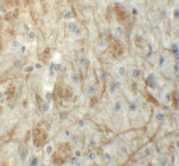 a11822 znf219 primary antibodies ihc testing 2