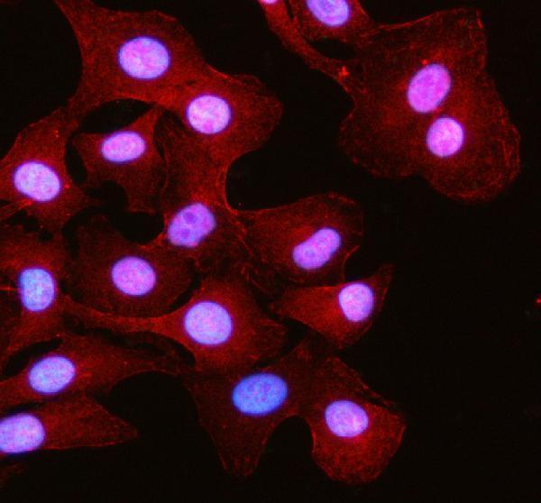  IF analysis of RSPH3 using anti-RSPH3 antibody (A11829)