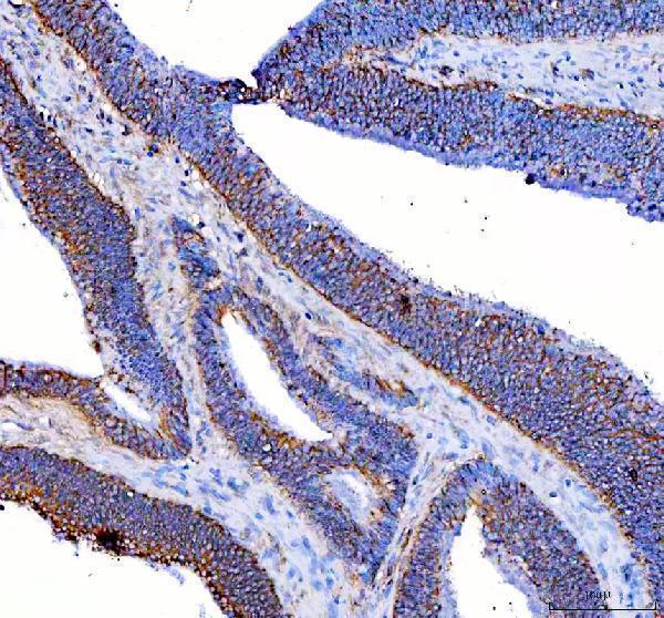  IHC analysis of RSPH3 using anti-RSPH3 antibody (A11829)