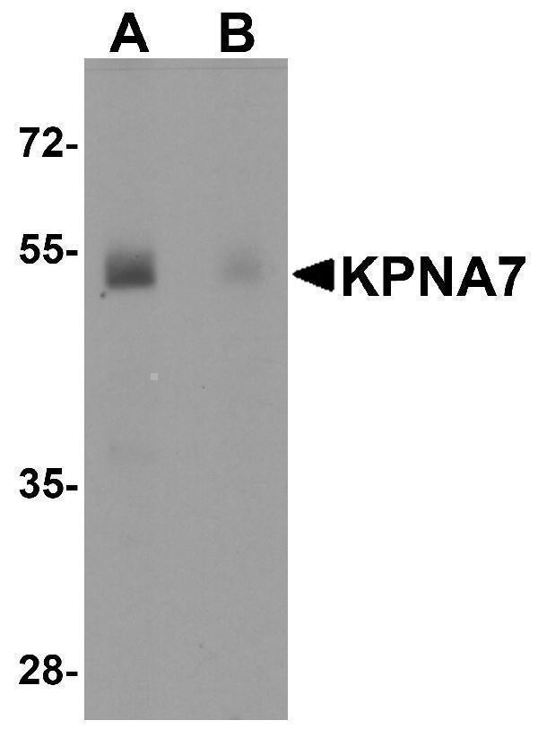 Western blot analysis of KPNA7 in human spleen with KPNA7 antibody at 1 μg/ml in (A) the absence and (B) the presence of blocking peptide