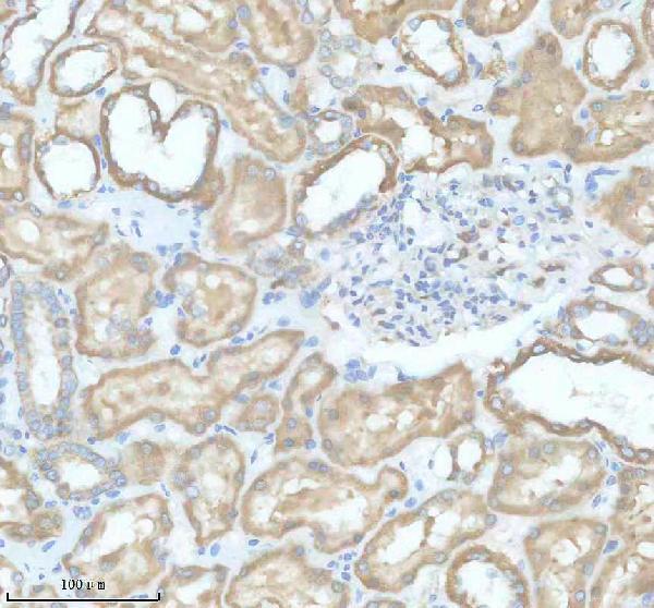 IHC analysis of SLC9A7 using anti-SLC9A7 antibody (A11831-2)