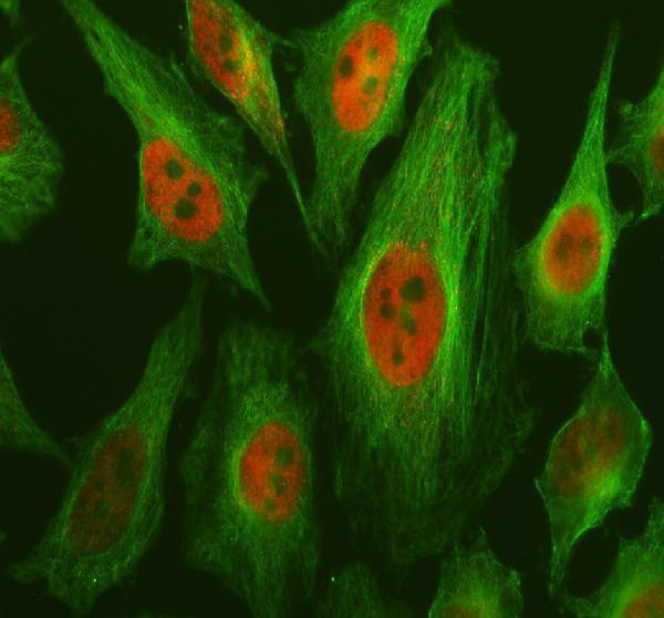 a11837 2 gtf3c2 primary antibodies if testing 1