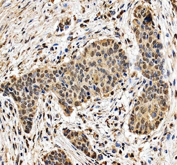 a11837 2 gtf3c2 primary antibodies ihc testing 1