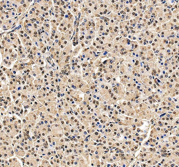 a11837 2 gtf3c2 primary antibodies ihc testing 2