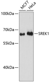 a11838 srek1 primary antiboties wb testing 1