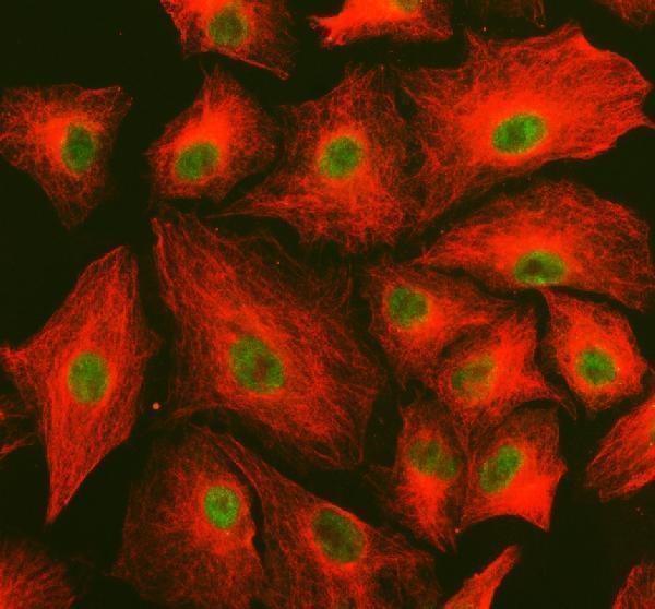 a11841 1 prtfdc1 primary antibodies if testing 1