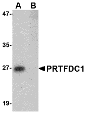 a11841 prtfdc1 primary antibodies wb testing 1