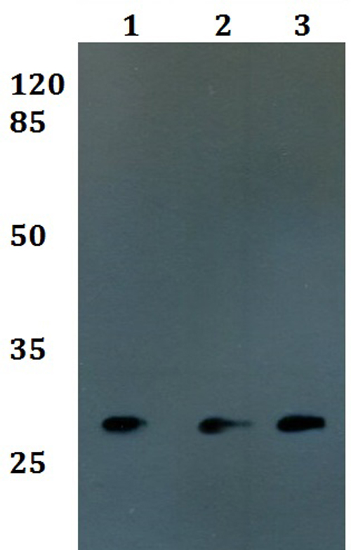 Western blot (WB) analysis of FOLR3 polyclonal antibody at 1:500 dilution
Lane1:MCF-7 whole cell lysate
Lane2:sp2/0 whole cell lysate
Lane3:Rat brain tissue lysate
