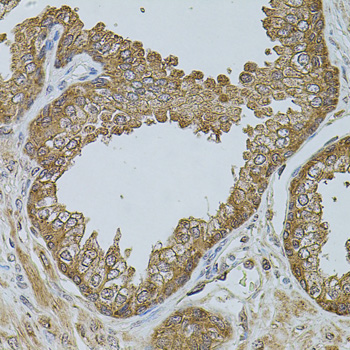 Immunohistochemistry of paraffin-embedded human prostate using CHRFAM7A antibody  at dilution of 1:100 
