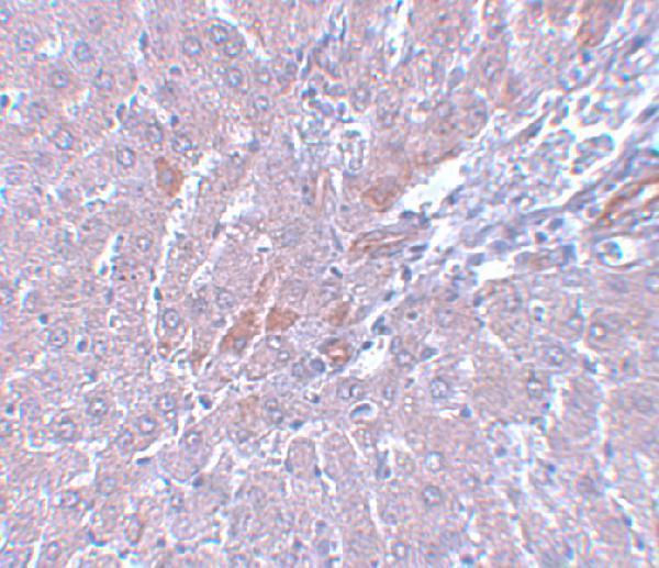 a11860 lyrm1 primary antibodies ihc testing 2