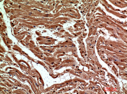 a11863 1 clec6a primary antibodyes ihc testing 3