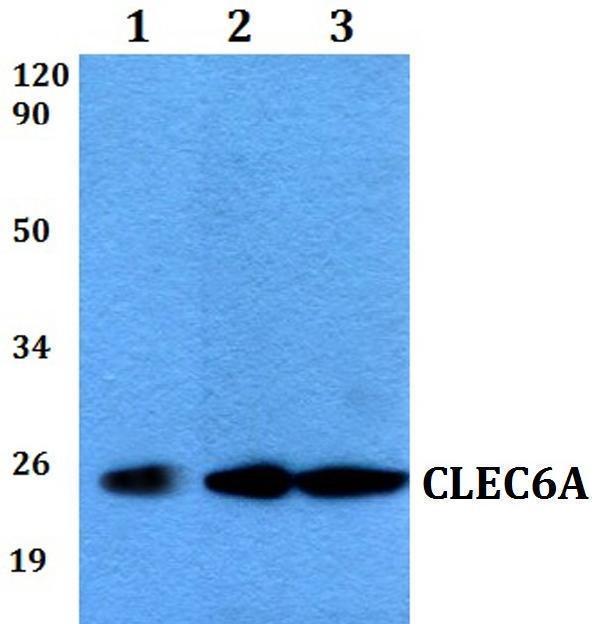 Western blot (WB) analysis of CLEC6A polyclonal antibody at 1:500 dilution
Lane1:MCF-7 whole cell lysate
Lane2:sp2/0 whole cell lysate 
Lane3:PC12 whole cell lysate 