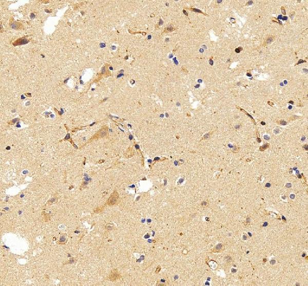 IHC analysis of SEMA4F using anti-SEMA4F antibody (A11873-2)