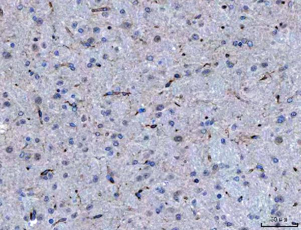 Figure 9. IHC analysis of SEMA4F using anti-SEMA4F antibody (A11873-2). SEMA4F was detected in a paraffin-embedded section of mouse brain tissue. Heat mediated antigen retrieval was performed in EDTA buffer (pH 8.0, epitope retrieval solution). The tissue section was blocked with 10% goat serum. The tissue section was then incubated with 2 microg/ml rabbit anti-SEMA4F Antibody (A11873-2) overnight at 4°C. Peroxidase Conjugated Goat Anti-rabbit IgG was used as secondary antibody and incubated for 30 minutes at 37°C. The tissue section was developed using HRP Conjugated Rabbit IgG Super Vision Assay Kit (Catalog # SV0002) with DAB as the chromogen. Figure 9. IHC analysis of SEMA4F using anti-SEMA4F antibody (A11873-2). SEMA4F was detected in a paraffin-embedded section of mouse brain tissue. Heat mediated antigen retrieval was performed in EDTA buffer (pH 8.0, epitope retrieval solution). The tissue section was blocked with 10% goat serum. The tissue section was then incubated with 2 microg/ml rabbit anti-SEMA4F Antibody (A11873-2) overnight at 4°C. Peroxidase Conjugated Goat Anti-rabbit IgG was used as secondary antibody and incubated for 30 minutes at 37°C. The tissue section was developed using HRP Conjugated Rabbit IgG Super Vision Assay Kit (Catalog # SV0002) with DAB as the chromogen.