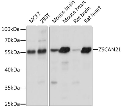 Western blot analysis of extracts of various cell lines, using ZSCAN21 antibody  at 1:1000 dilution
