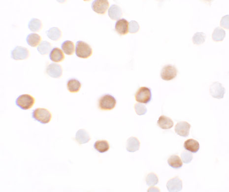 a11875 kremen2 primary antibodies icc testing 4