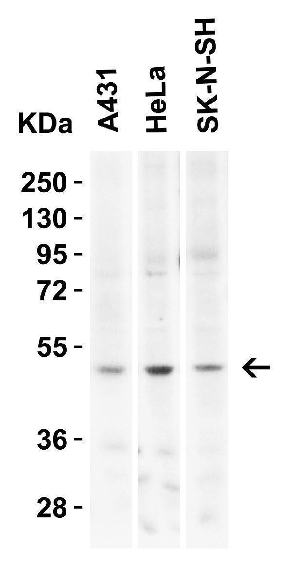 a11875 kremen2 primary antibodies wb testing 2