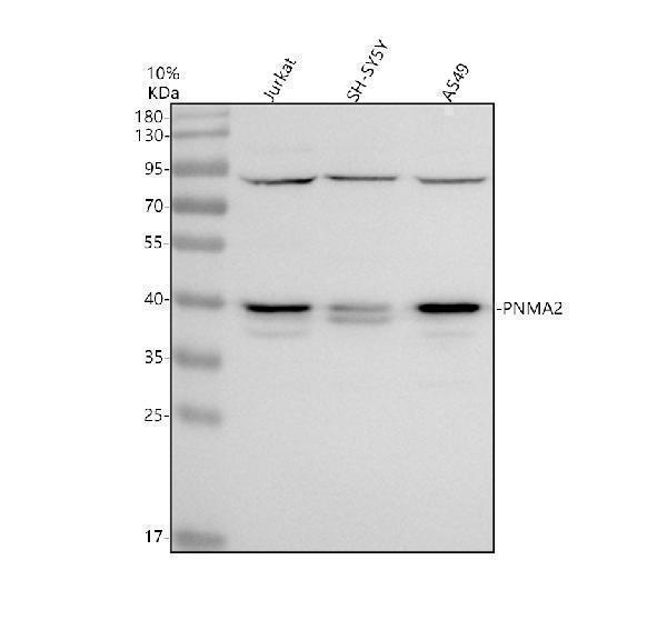 Western blot analysis of PNMA2 using anti-PNMA2 antibody (A11880-1)